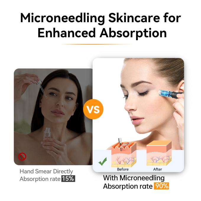मूल ब्रांड हाइड्रा पेन एच5 माइक्रोनीडलिंग डर्मा पेन ईएमएस समायोज्य सीरम आउटपुट के साथ एमटीएस निशान को कम करें बारीक रेखाएं झुर्रियां 5