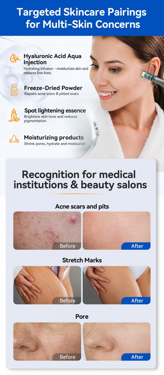 मूल ब्रांड हाइड्रा पेन एच5 माइक्रोनीडलिंग डर्मा पेन ईएमएस समायोज्य सीरम आउटपुट के साथ एमटीएस निशान को कम करें बारीक रेखाएं झुर्रियां 6