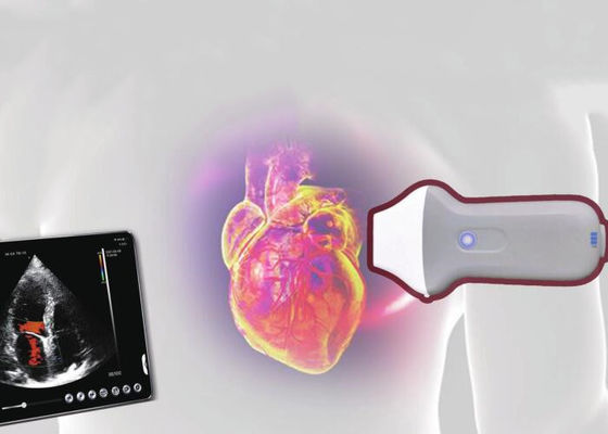 पीडीआई वाईफाई वायरलेस पोर्टेबल अल्ट्रासाउंड स्कैनर 128 तत्व